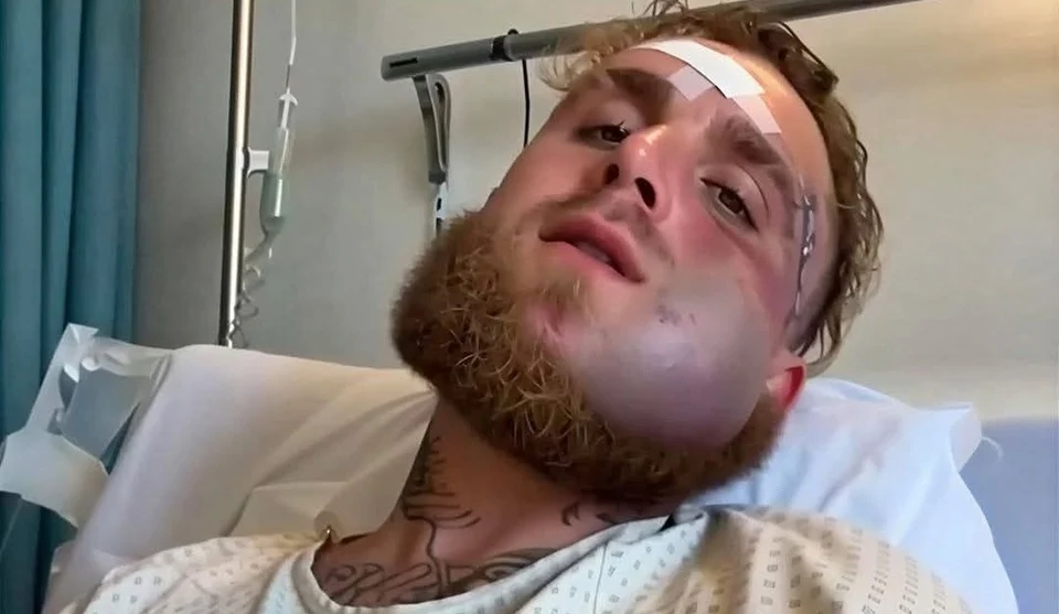 Jake Paul berbaring di ranjang rumah sakit dengan wajah bengkak dan memar, perban menempel di dahinya, mengenakan pakaian rumah sakit, menunjukkan kondisi setelah cedera serius.